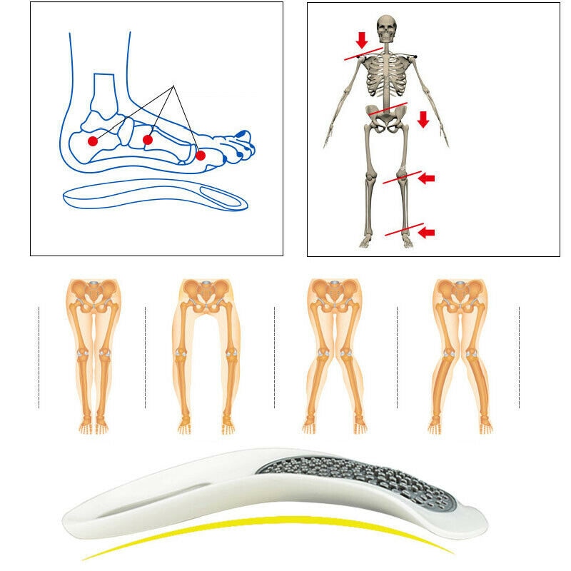 Platinum Foot Orthotics